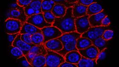 علامة مميزة لظهور السرطان