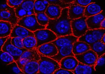 علامة مميزة لظهور السرطان