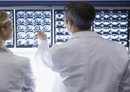 توصيات لتجنب الإصابة بالجلطة الدماغية