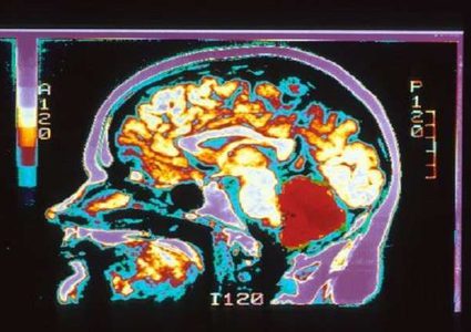 أوجه الاختلاف بين دماغ الرجل والمرأة!
