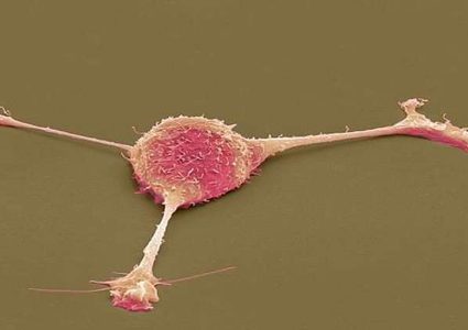 فيروس معدل وراثيا يقتل الخلايا السرطانية