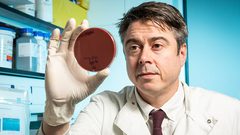 دراسة:بكتيريا البشرة يمكن أن تكون "قاتلة"!