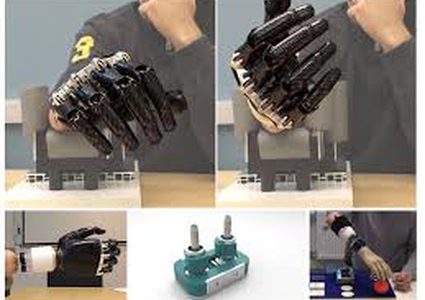 مفصل صناعي جديد يعيد الدوران للمعصم