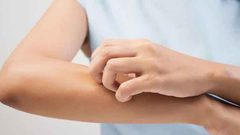 علماء يحذرون من "قاتل" يعيش على جلد الجميع!