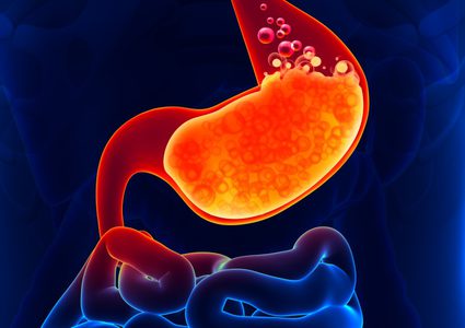 نصائح "فعالة" للتخفيف من آثار حموضة المعدة الشديدة