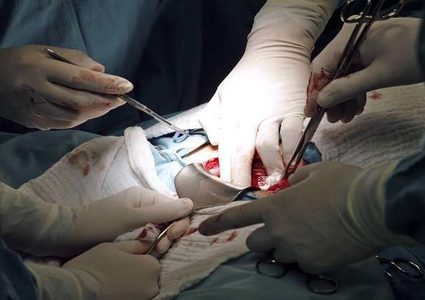 طبيب مخمور "يقتل" حاملا وجنينها!