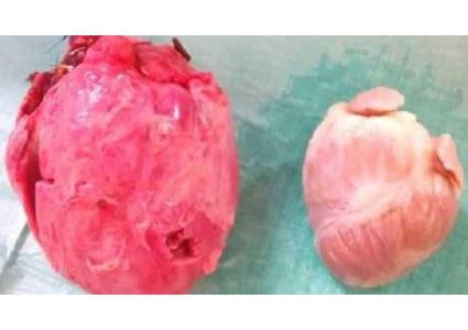 أعضاء الحيوانات ستنقل إلى البشر!