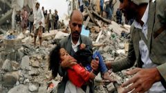 الأمم المتحدة: 123 ضحية في اليمن أسبوعياً