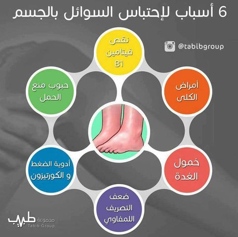أسباب لاحتباس السوائل بالجسم