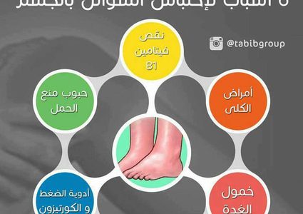 أسباب لاحتباس السوائل بالجسم