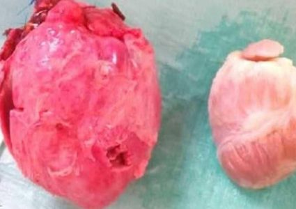 أعضاء الحيوانات ستنقل إلى البشر