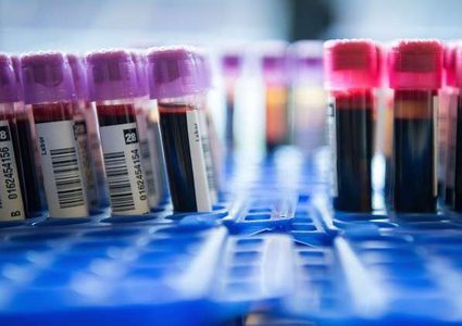 تغيير توصيات اختبارات مستوى الكوليسترول