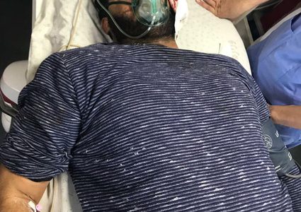 إصابة 3 صحفيين بقنابل الغاز والرصاص المطاطي في الضفة والقطاع