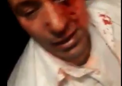 إصابة مقدسي جراء الاعتداء عليه من قطعان المستوطنين