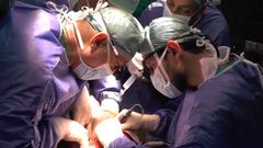 الشروط الواجب توفرها للتبرع بالكبد