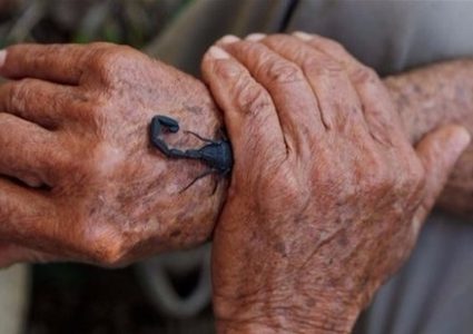 عجوز يلدغ نفسه بعقرب شهرياً