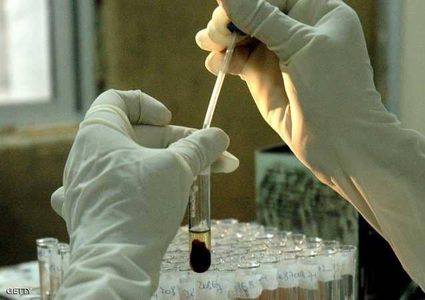 "نقطة ضعف" تفتح باب القضاء على "الإيدز"