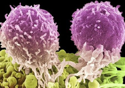 علاج جديد يدمر خلايا سرطان البروستاتا