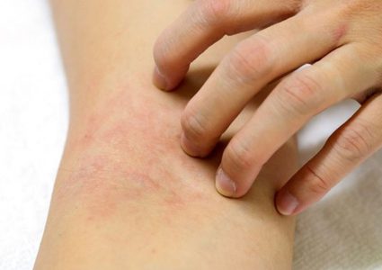 جهاز حساس يمكن أن يساعد في منع سرطان الجلد