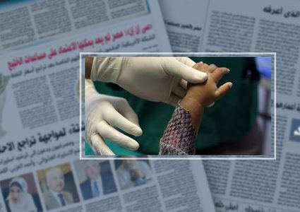 تعرف على الطريقة الجديدة لعلاج الحروق ب "جلد السمك"