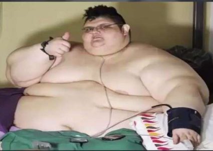 أسمن رجل في العالم يفقد 220 كلغم من وزنه
