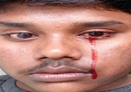 شاب يبكي دما.. ونتائج فحوصاته تحير الأطباء