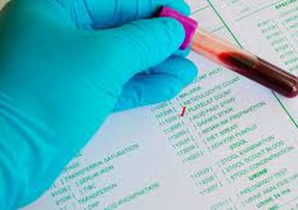 اكتشاف ثوري..اختبار دم جديد يكشف خطورة تعرضك للسكتة الدماغية