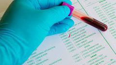 اكتشاف ثوري..اختبار دم جديد يكشف خطورة تعرضك للسكتة الدماغية