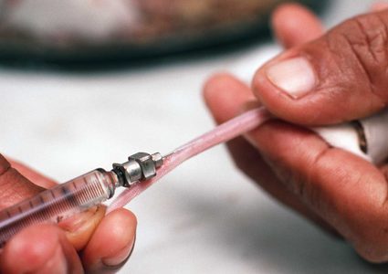 هل يعالج  نقل "الدم الشاب" مرض باركنسون المزمن ؟