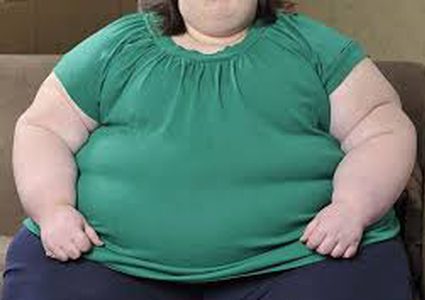 خبراء : يجب تصنيف السمنة كمرض