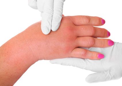 ما يحدث في جسمك عند نقصان نسبة البوتاسيوم