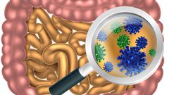 دراسة: "ميكروبات الأمعاء" هي السبب الرئيسي وراء مرض الزهايمر