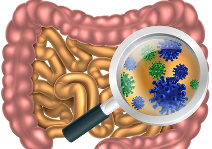 دراسة: "ميكروبات الأمعاء" هي السبب الرئيسي وراء مرض الزهايمر