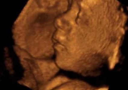 تشوهات الجنين: الأسباب، الأنواع،العوامل، الوقاية!