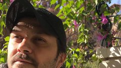 معتز عكيد "باب الحارة" يذهل الجميع بتغيّر شكله
