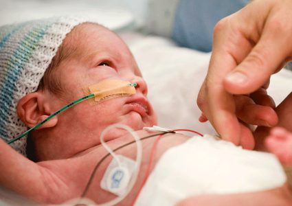 ولادة طفلة بكلية واحدة في روسيا