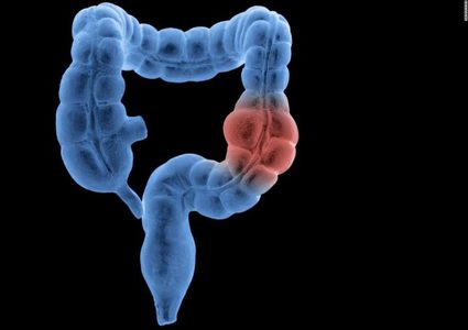 ما هي أفضل الطرق الطبيعية لتنظيف القولون؟