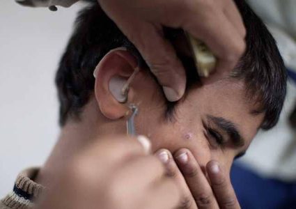 كيف تعالج "انسداد الأذن" وتنظفها بطريقة صحيحة؟