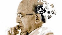 علماء يكتشفون علاج جديد لمرض الزهايمر المزمن