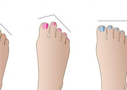 هل تعرفين أن شكل أصابع القدمين قد تقول الكثير عن الشخص؟