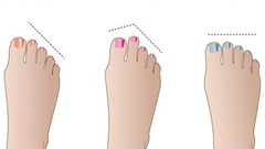 هل تعرفين أن شكل أصابع القدمين قد تقول الكثير عن الشخص؟