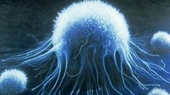 سبعة أعراض رئيسية للسرطان