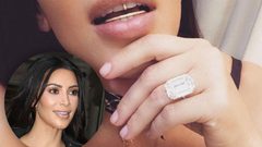 سعر لا يُصدق لأسنان «كيم كاردشيان» الماسيّة.. تعرفوا إليه