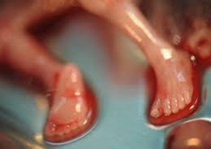 مداهمة "صالون الإجهاض" باسطنبول واعتقال سوريين