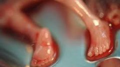 مداهمة "صالون الإجهاض" باسطنبول واعتقال سوريين