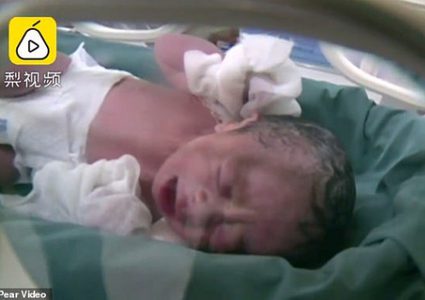 معجزة طبية ... سيدة تضع جنينها بدون رحم