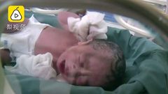 معجزة طبية ... سيدة تضع جنينها بدون رحم