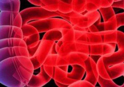 الجلطة المعوية: الأسباب، والأعراض، والعلاج