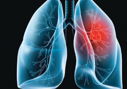 علاج نقص هذا الفيتامين يحمي من أمراض الرئة والإنفلونزا