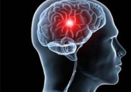 حالة شائعة تنذر بخطر الوفاة بالسكتة الدماغية